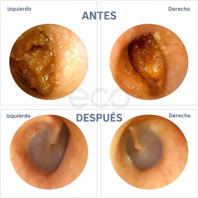 Limpiador Oidos Camara