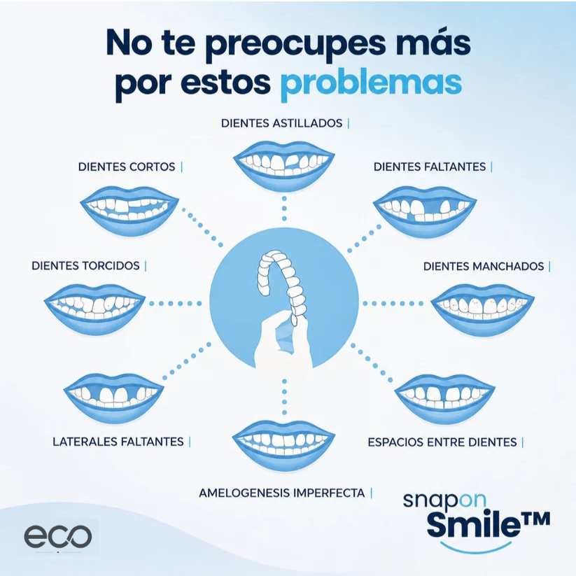 Snap On Smile - Confianza instantánea en tu sonrisa